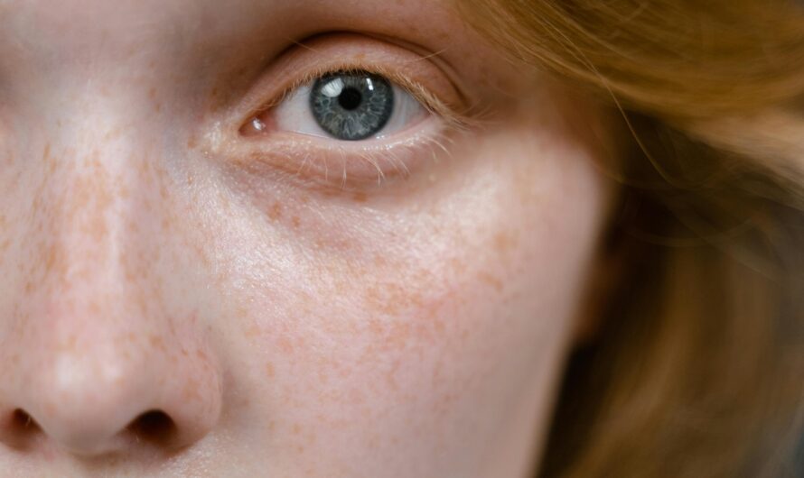 Why Pores, Texture, and Acne Are Normal — Not Flaws