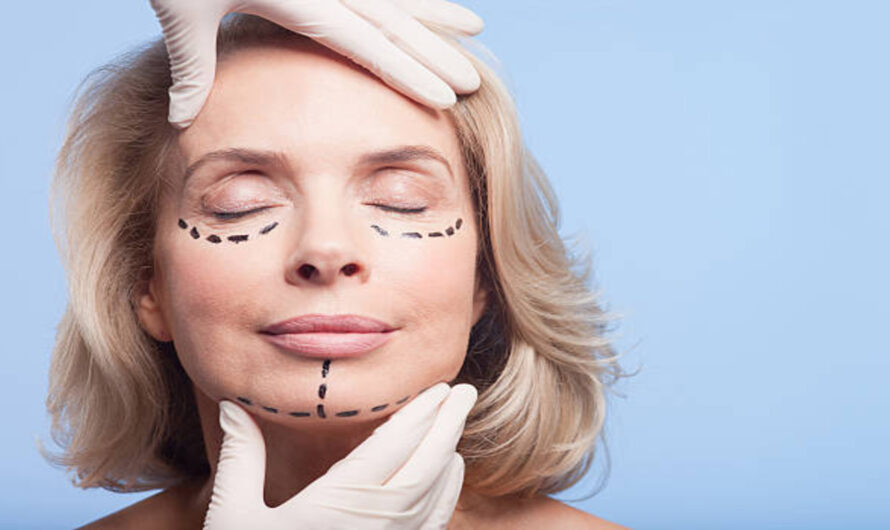 Why Celebrity Plastic Surgery Transparency Is Increasing