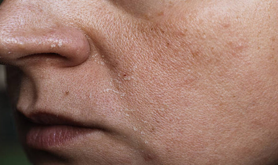 The Cultural Return to Freckles and Natural Texture