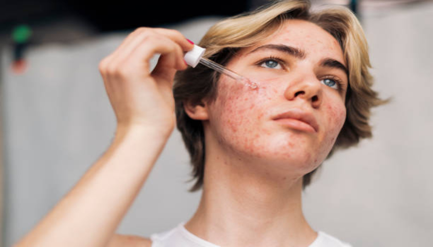 https://media.gettyimages.com/id/1702003039/photo/contemplative-young-man-using-face-serum-against-white-background.jpg?s=612x612&w=0&k=20&c=mR6DhaKrgsddp62iaY8ihi-ax82CcxhUSn-O0msddog=