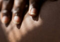 https://media.gettyimages.com/id/1399526483/photo/close-up-view-of-woman-applying-acne-cream-to-her-body-at-home.jpg?s=612x612&w=0&k=20&c=FkDHHE4ckMgSPAjapOLTU7sQmCrcpO4rkAtf5zM5VvE=